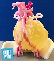 3D printed anatomical model